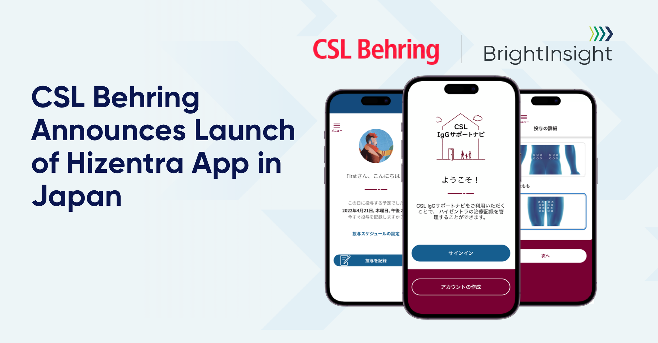 Csl japan blog